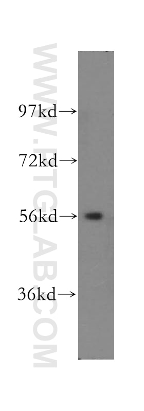 Western Blot (WB) analysis of mouse heart tissue using SMYD1-Specific Polyclonal antibody (16151-1-AP)