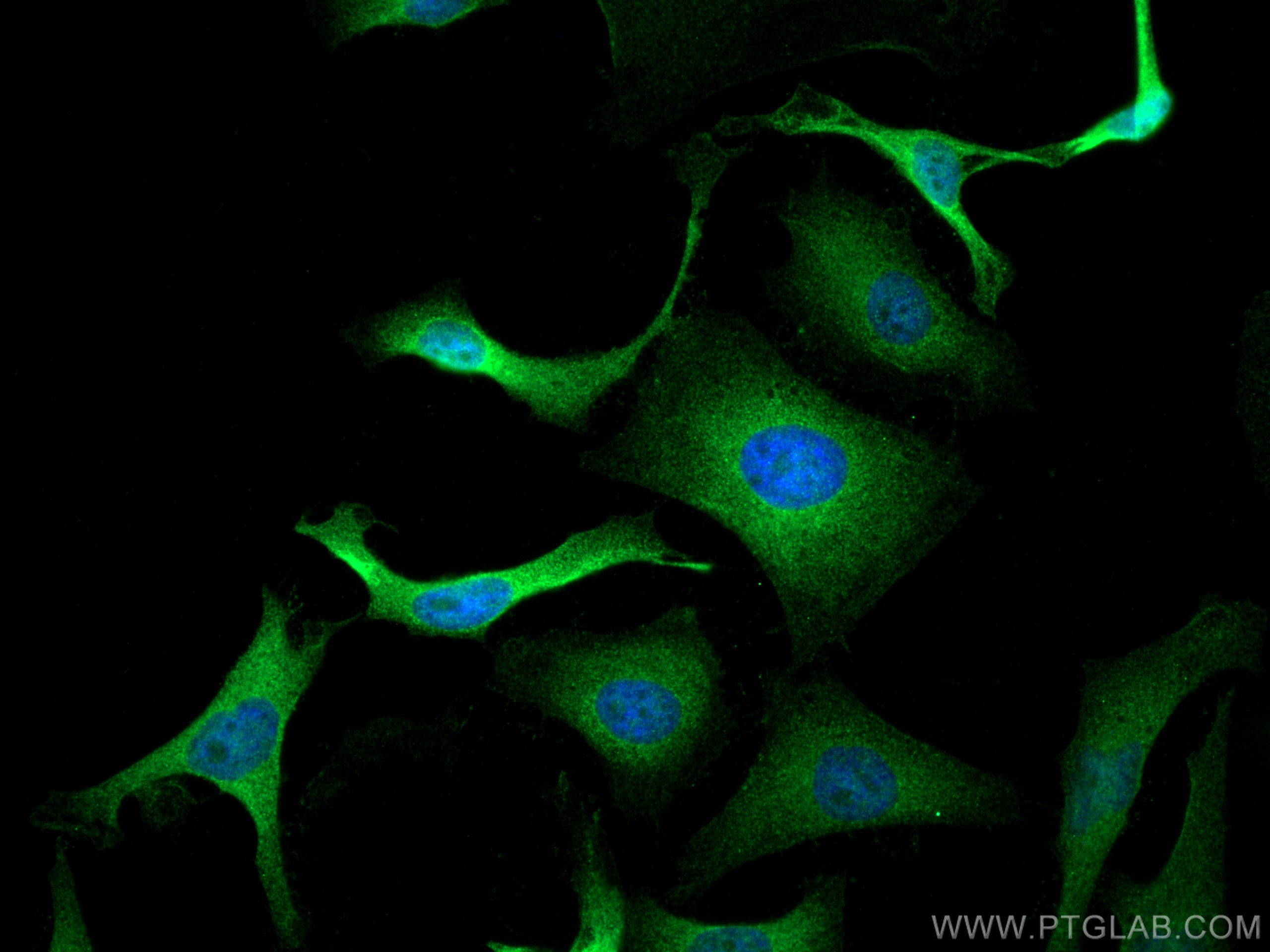 Immunofluorescence (IF) / fluorescent staining of HeLa cells using SMYD2 Polyclonal antibody (21290-1-AP)