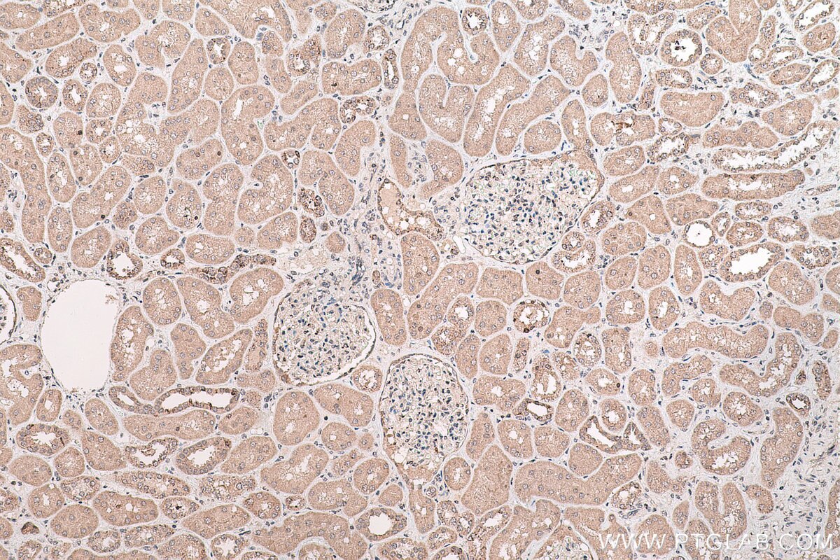 Immunohistochemistry (IHC) staining of human kidney tissue using SMYD2 Polyclonal antibody (21290-1-AP)
