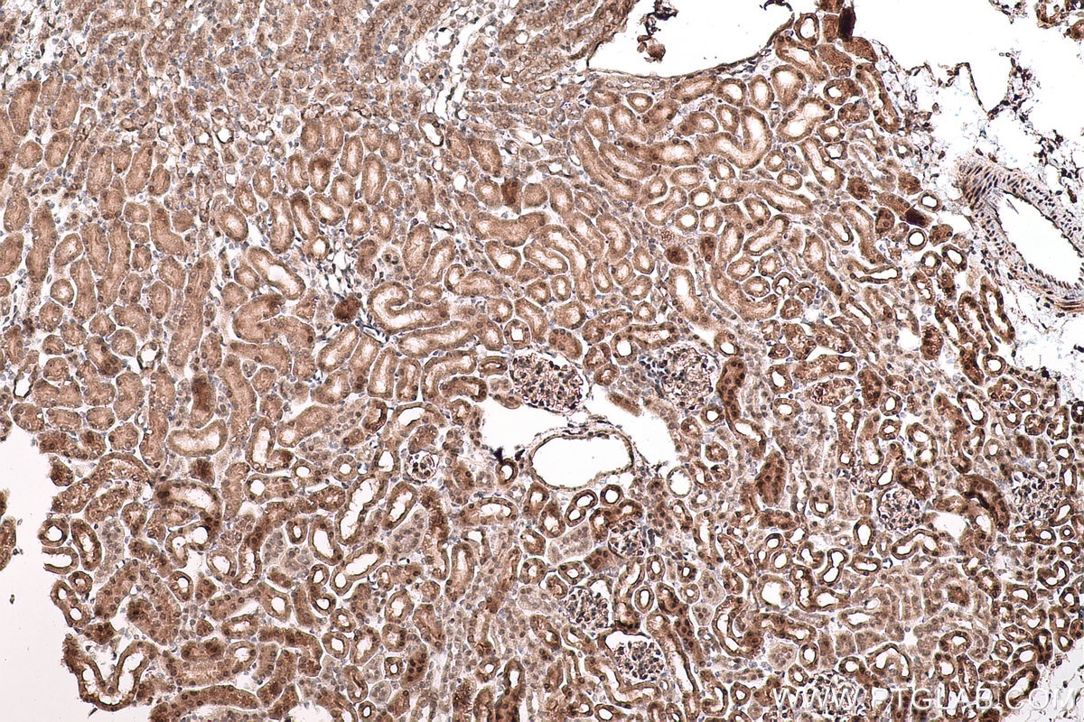 Immunohistochemistry (IHC) staining of mouse kidney tissue using SMYD2 Polyclonal antibody (21290-1-AP)