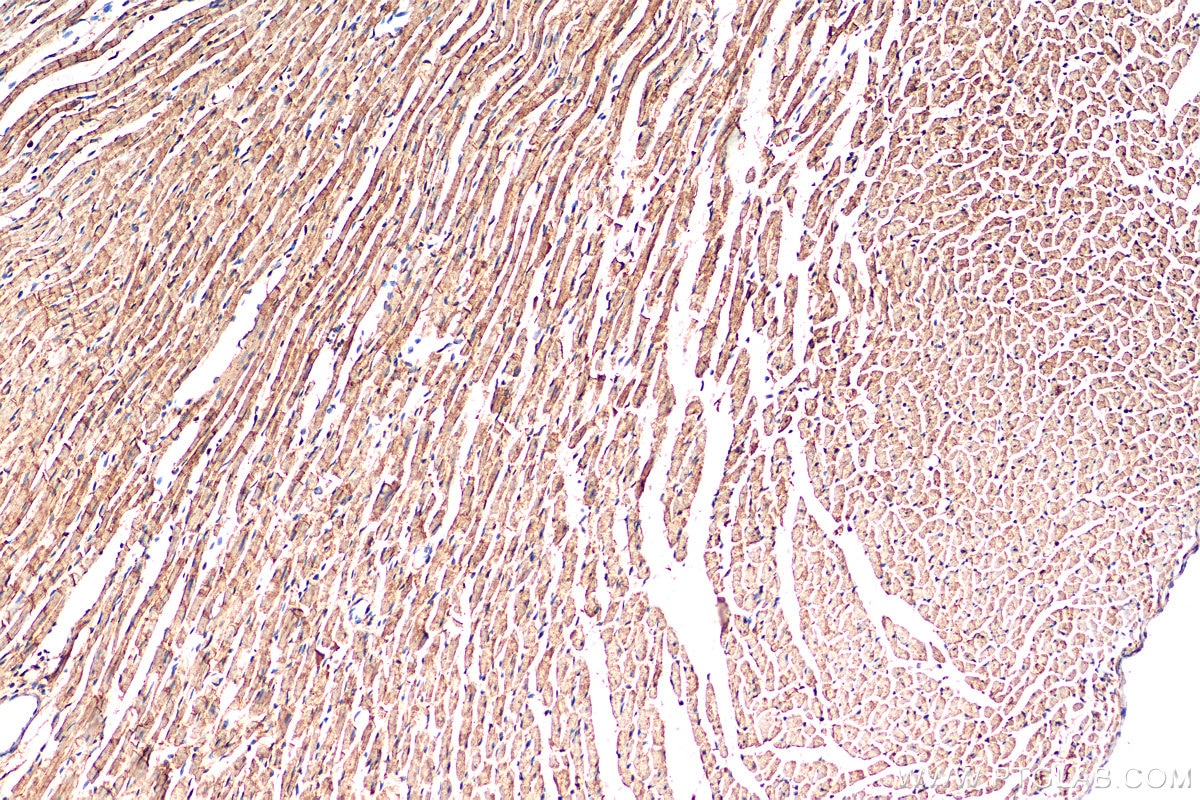 Immunohistochemistry (IHC) staining of rat heart tissue using SMYD2 Polyclonal antibody (21290-1-AP)
