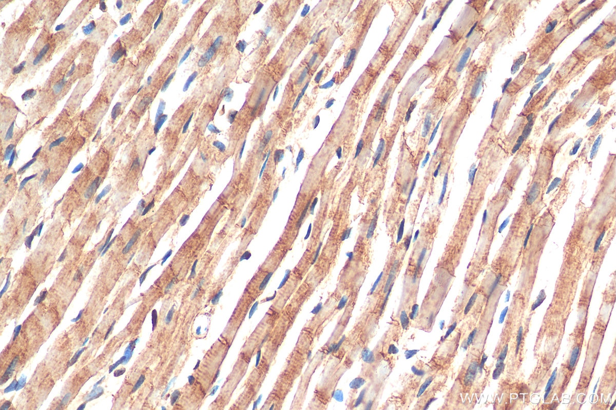 Immunohistochemistry (IHC) staining of rat heart tissue using SMYD2 Polyclonal antibody (21290-1-AP)