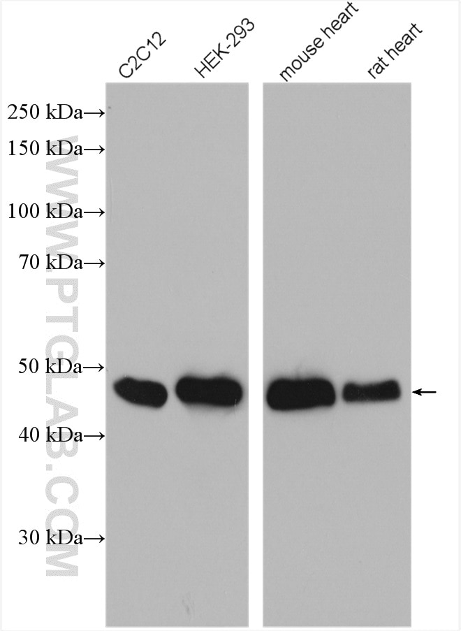 Western Blot (WB) analysis of various lysates using SMYD2 Polyclonal antibody (21290-1-AP)