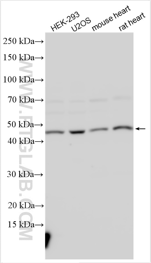 Western Blot (WB) analysis of various lysates using SMYD2 Polyclonal antibody (21290-1-AP)
