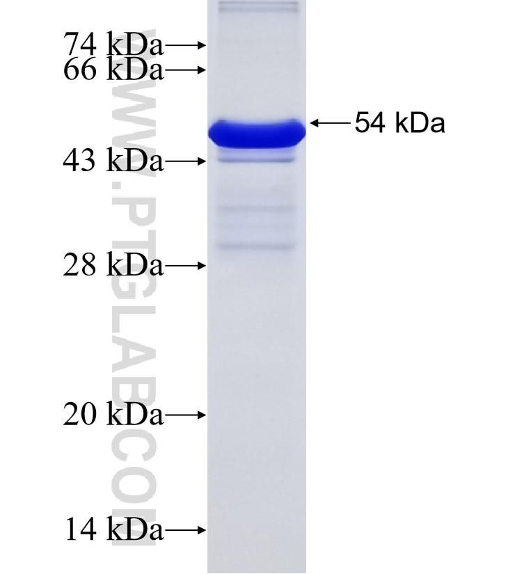 SMYD2 fusion protein Ag15823 SDS-PAGE
