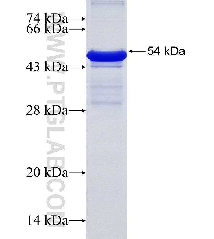 SMYD2 fusion protein Ag15823 SDS-PAGE