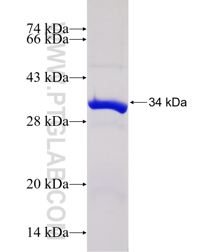 SMYD2 fusion protein Ag17190 SDS-PAGE