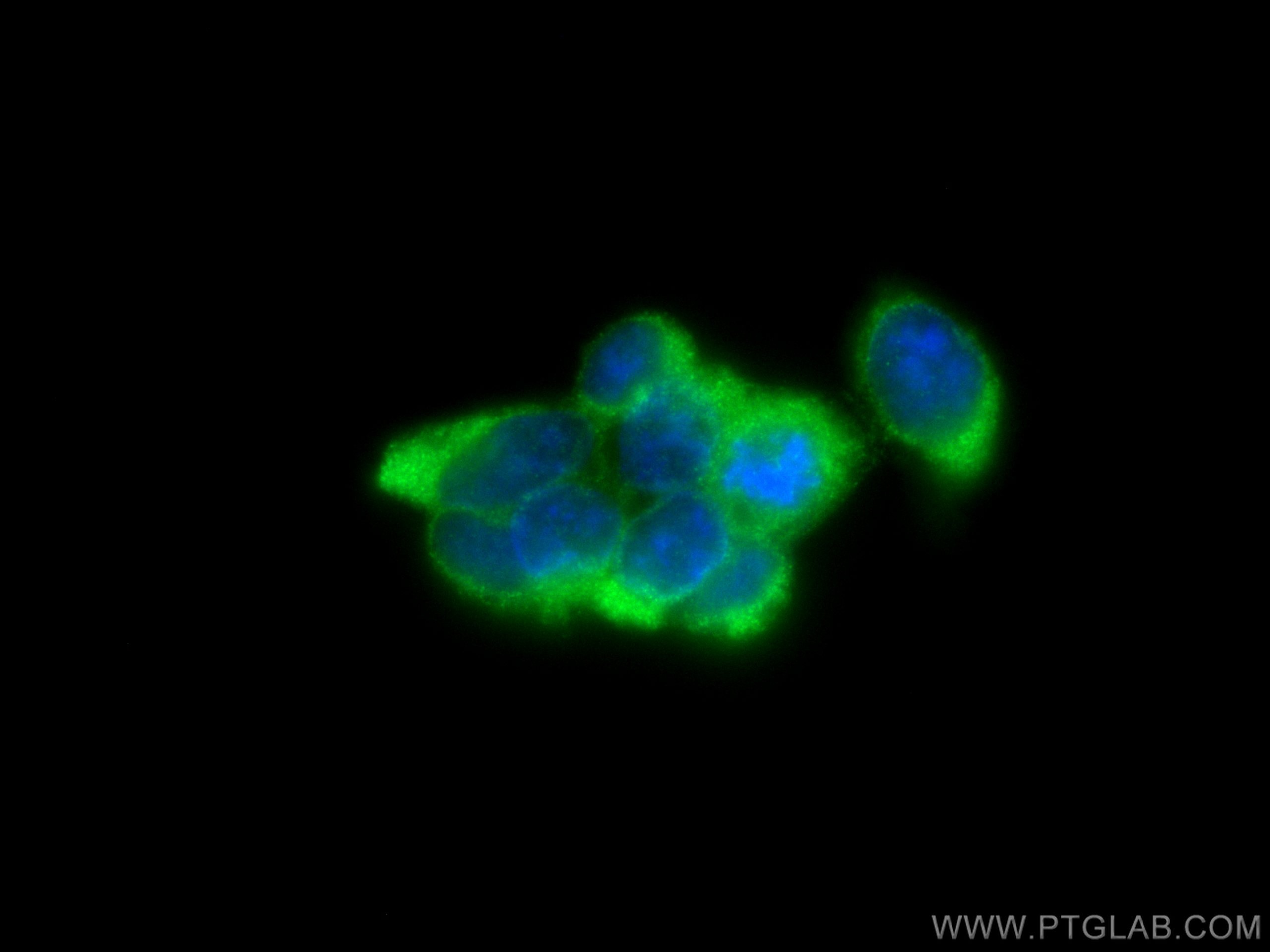Immunofluorescence (IF) / fluorescent staining of HEK-293 cells using SMYD3 Polyclonal antibody (12011-1-AP)