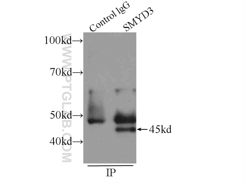Immunoprecipitation (IP) experiment of COLO 320 cells using SMYD3 Polyclonal antibody (12011-1-AP)