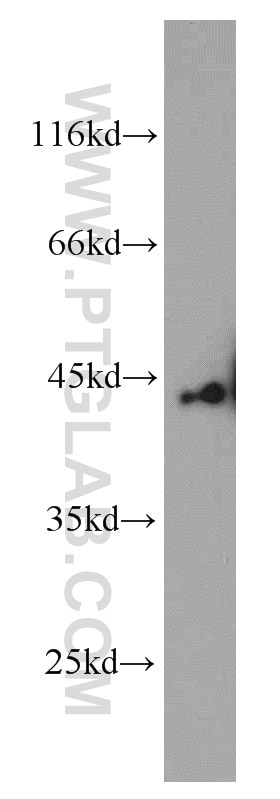 Western Blot (WB) analysis of HeLa cells using SMYD3 Polyclonal antibody (12011-1-AP)