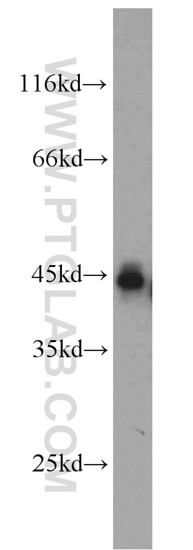 Western Blot (WB) analysis of mouse brain tissue using SMYD3 Polyclonal antibody (12011-1-AP)