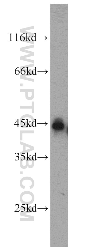 WB analysis of mouse brain using 12011-1-AP