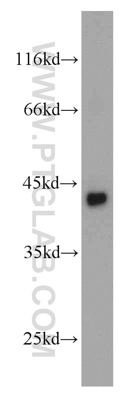 Western Blot (WB) analysis of mouse brain tissue using SMYD3 Polyclonal antibody (12011-1-AP)