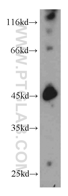 Western Blot (WB) analysis of mouse brain tissue using SMYD3 Polyclonal antibody (12011-1-AP)