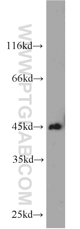 Western Blot (WB) analysis of HeLa cells using SMYD3 Polyclonal antibody (12011-1-AP)