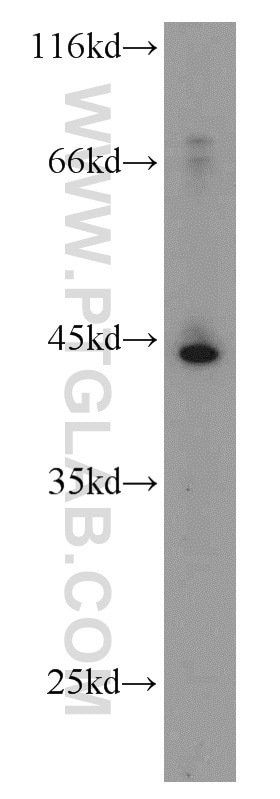Western Blot (WB) analysis of HepG2 cells using SMYD3 Polyclonal antibody (12011-1-AP)