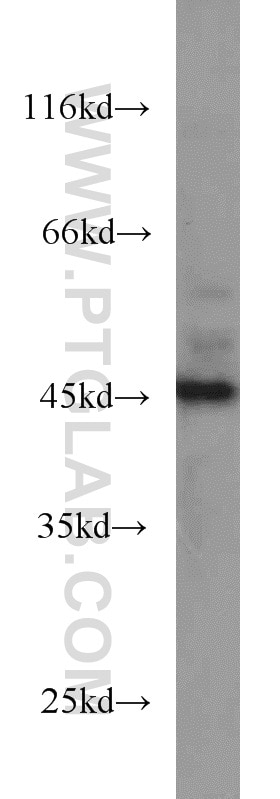 Western Blot (WB) analysis of COLO 320 cells using SMYD3 Polyclonal antibody (12011-1-AP)