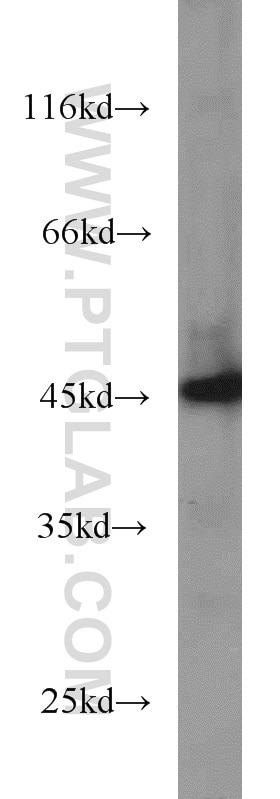 Western Blot (WB) analysis of COLO 320 cells using SMYD3 Polyclonal antibody (12011-1-AP)