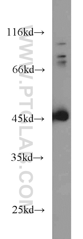 Western Blot (WB) analysis of COLO 320 cells using SMYD3 Polyclonal antibody (12011-1-AP)