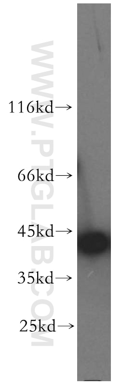 Western Blot (WB) analysis of HeLa cells using SMYD3 Polyclonal antibody (12011-1-AP)