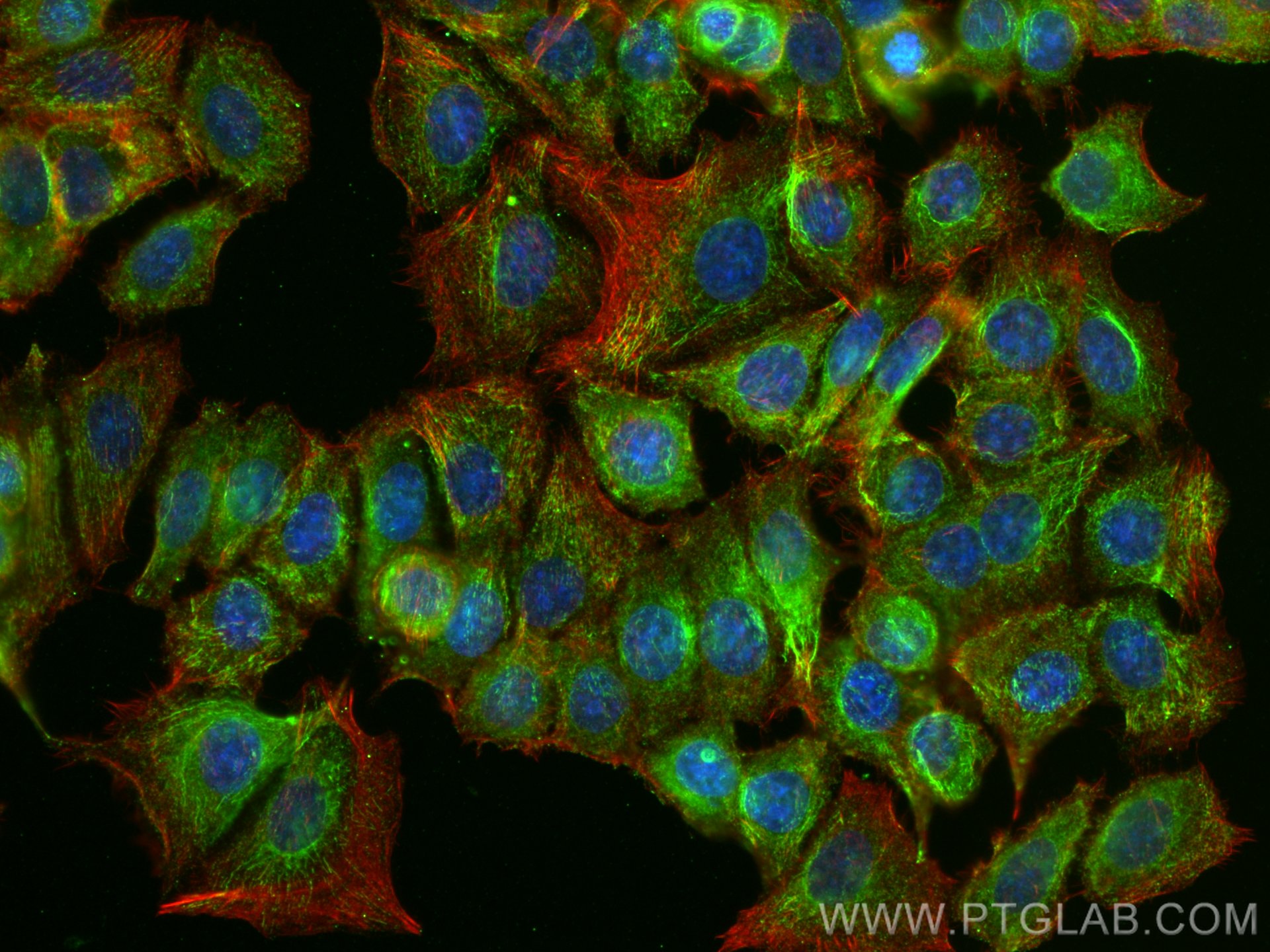 Immunofluorescence (IF) / fluorescent staining of MCF-7 cells using SMYD3 Monoclonal antibody (66330-1-Ig)