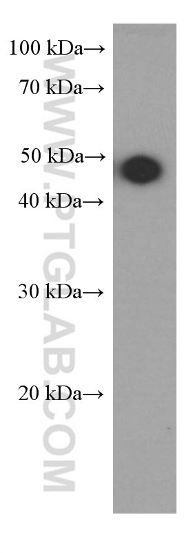 WB analysis of A431 using 66330-1-Ig