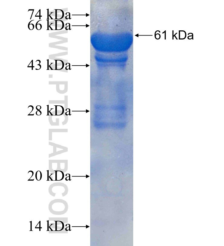 SMYD3 fusion protein Ag2624 SDS-PAGE