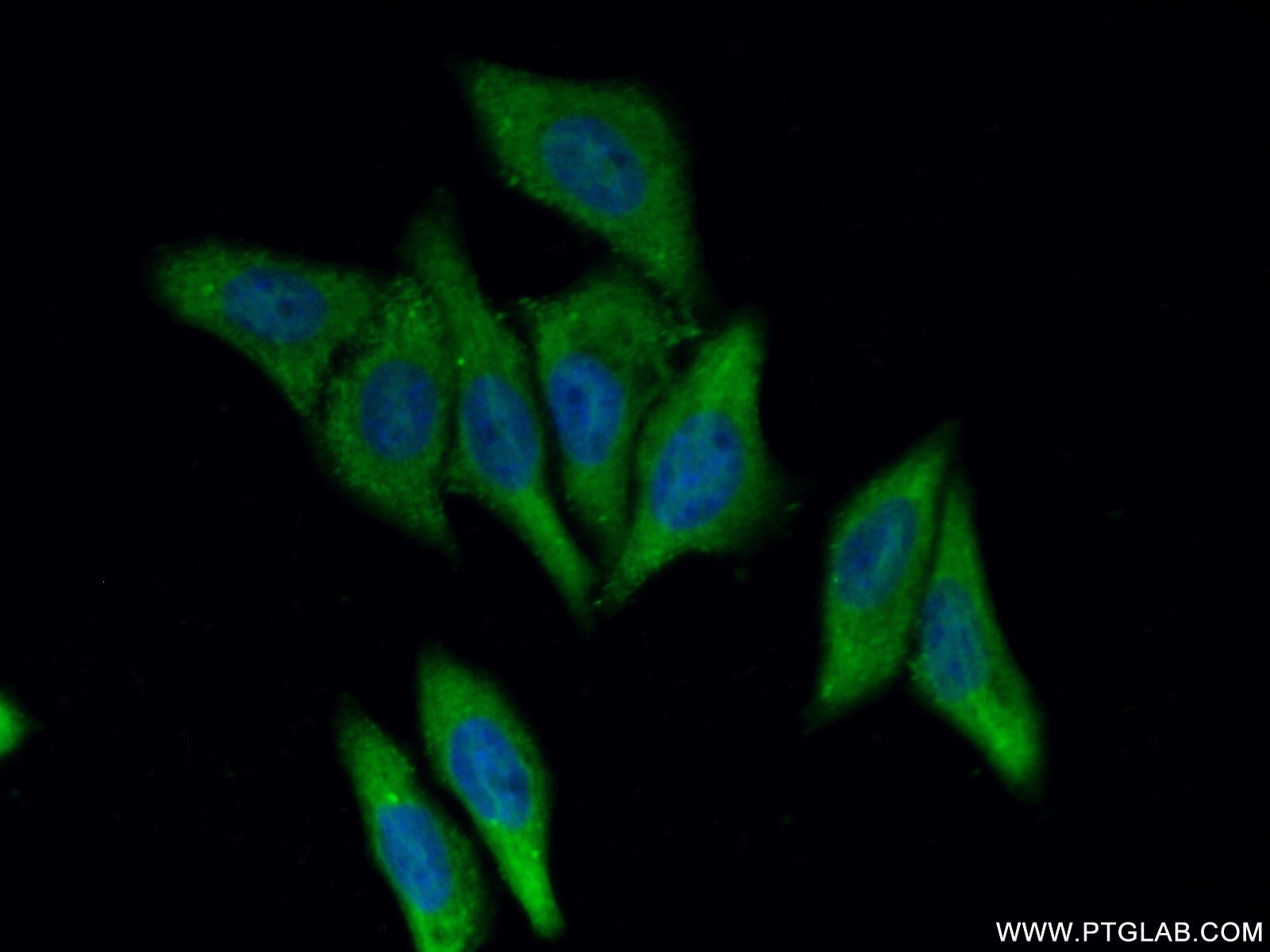 Immunofluorescence (IF) / fluorescent staining of HepG2 cells using SMYD4 Polyclonal antibody (17594-1-AP)