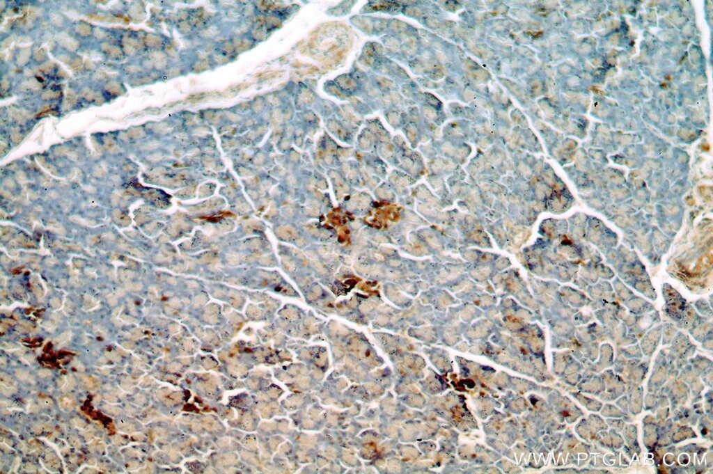 IHC staining of human pancreas using 17594-1-AP