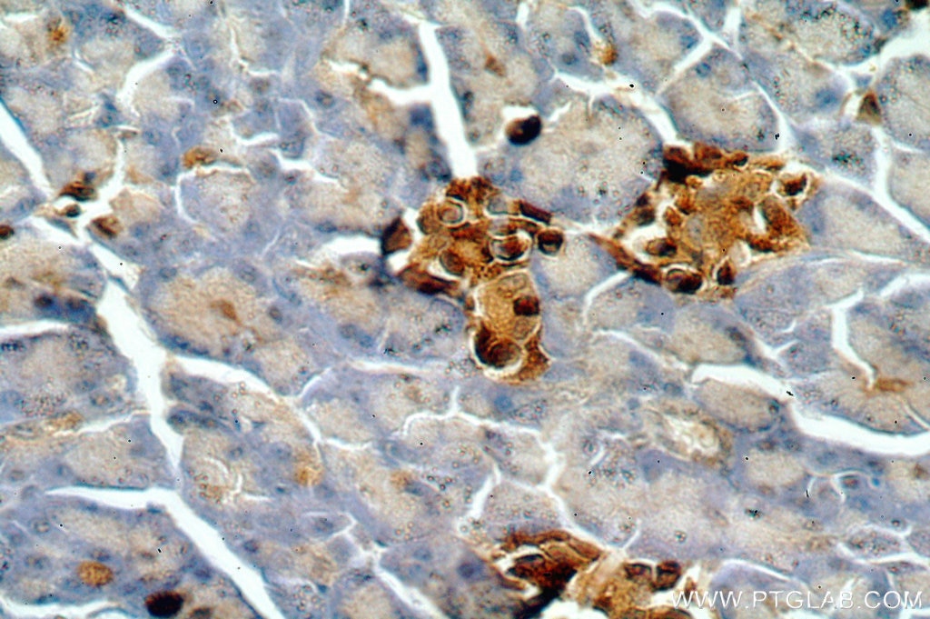 Immunohistochemistry (IHC) staining of human pancreas tissue using SMYD4 Polyclonal antibody (17594-1-AP)