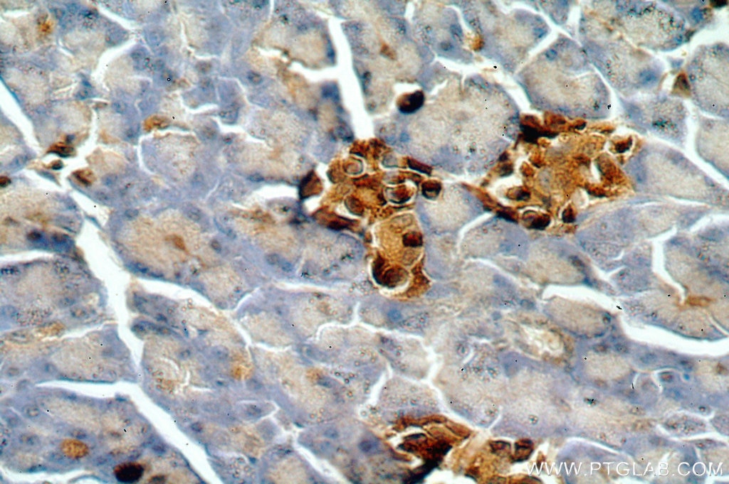 IHC staining of human pancreas using 17594-1-AP