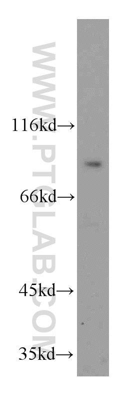 Western Blot (WB) analysis of HepG2 cells using SMYD4 Polyclonal antibody (17594-1-AP)