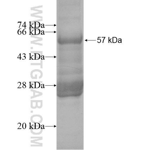 SMYD4 fusion protein Ag11526 SDS-PAGE