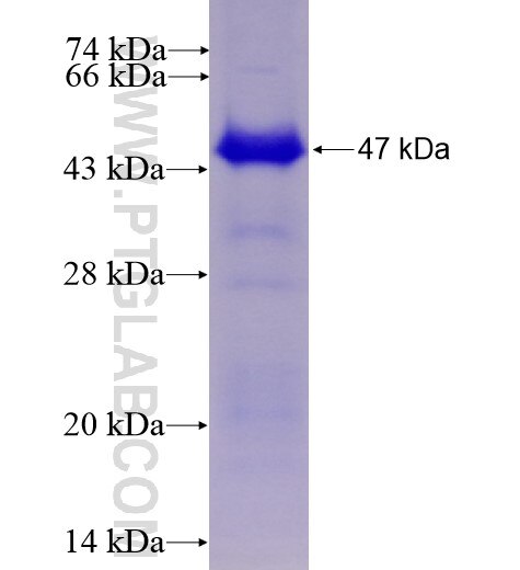 SMYD4 fusion protein Ag11552 SDS-PAGE