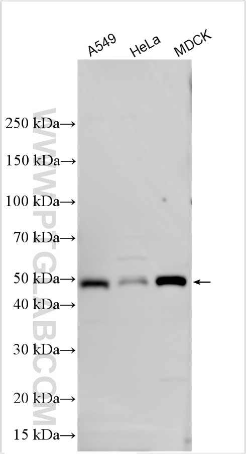 Western Blot (WB) analysis of various lysates using SMYD5 Polyclonal antibody (16810-1-AP)