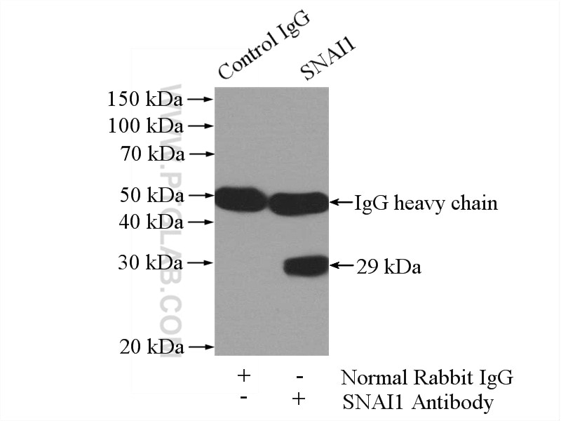 IP experiment of MCF-7 using 13099-1-AP