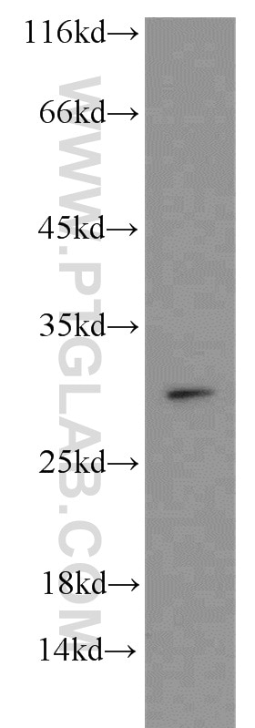 Western Blot (WB) analysis of mouse heart tissue using SNAI1 Polyclonal antibody (13099-1-AP)