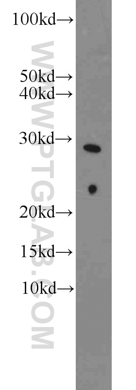 SNAI1 Polyclonal antibody