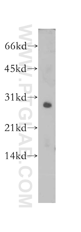 Western Blot (WB) analysis of human heart tissue using SNAI1 Polyclonal antibody (13099-1-AP)