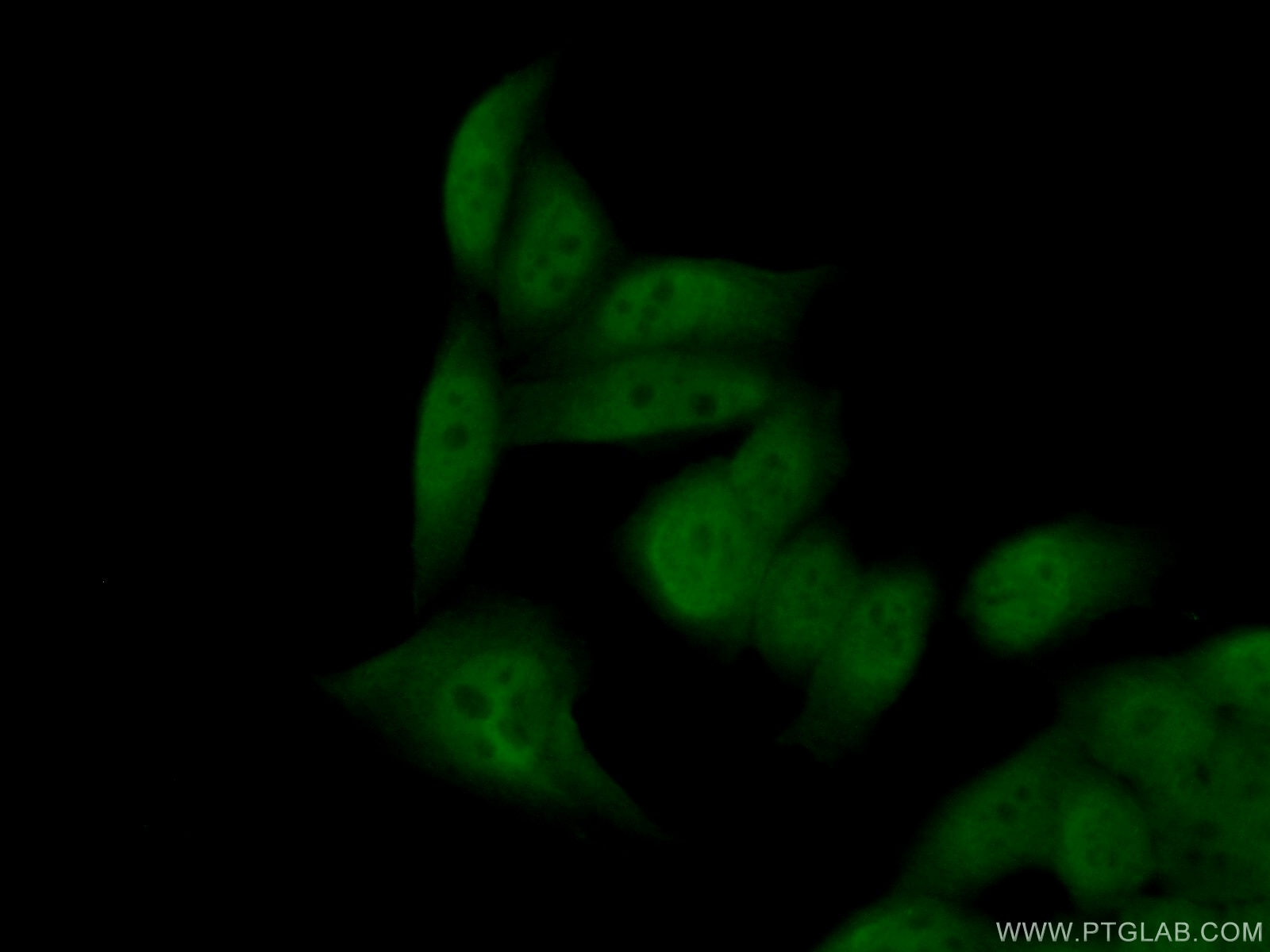 Immunofluorescence (IF) / fluorescent staining of HeLa cells using SNAI1 Polyclonal antibody (26183-1-AP)