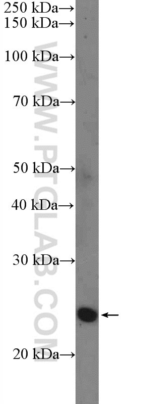 Western Blot (WB) analysis of PC-3 cells using SNAI1 Polyclonal antibody (26183-1-AP)