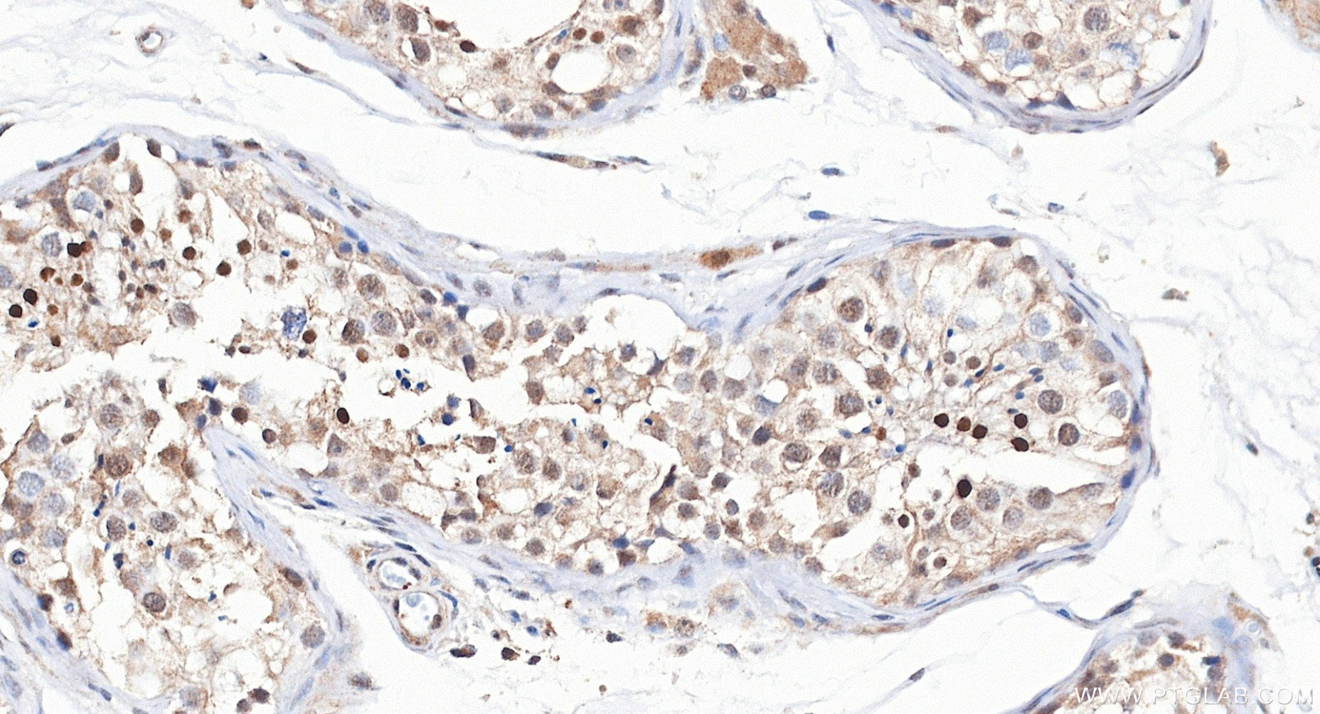 IHC staining of human testis using 81584-4-RR (same clone as 81584-4-PBS) Immunohistochemistry (IHC) staining of human testis tissue using SNAI1 Recombinant monoclonal antibody (81584-4-RR)