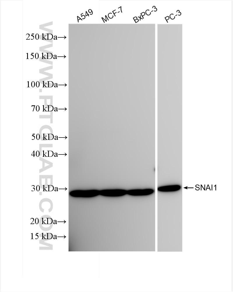 SNAI1