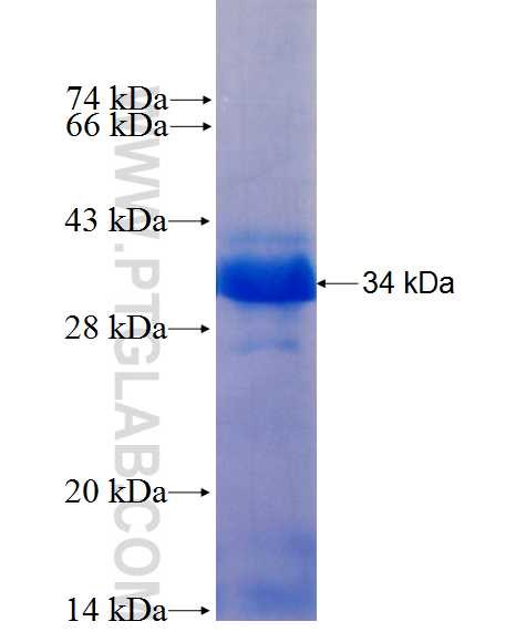 SNAI1 fusion protein Ag23845 SDS-PAGE