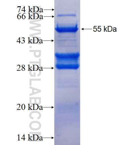 SNAI1 fusion protein Ag3723 SDS-PAGE