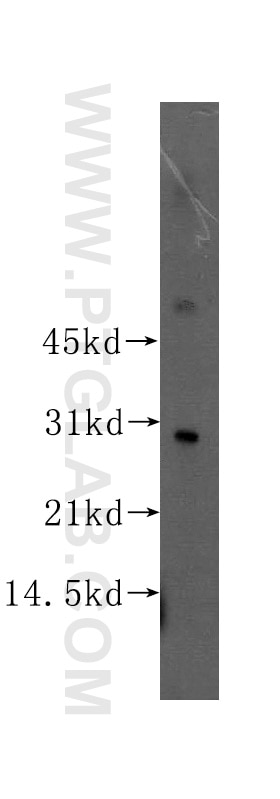 SNAI2/SLUG Polyclonal antibody