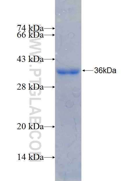 SNAI2 fusion protein Ag26439 SDS-PAGE