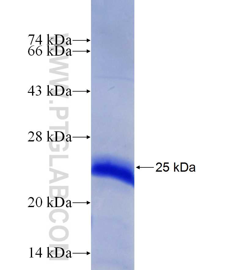 SNAI2 fusion protein Ag29695 SDS-PAGE SNAI2 fusion protein Ag29695 SDS-PAGE