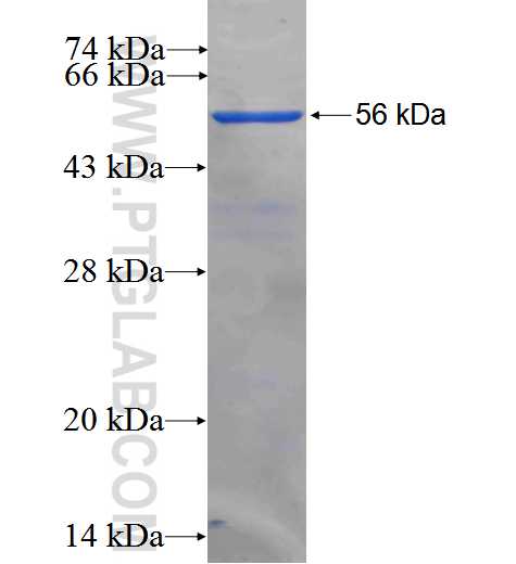 SNAI2 fusion protein Ag2773 SDS-PAGE