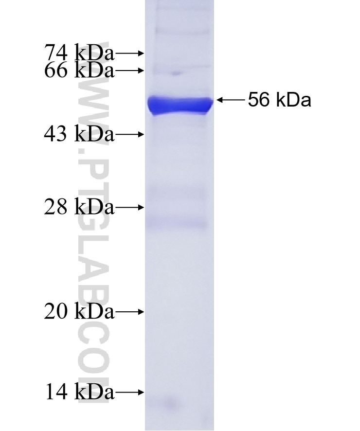 SNAI2 fusion protein Ag2773 SDS-PAGE